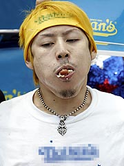 Hot Dog Eating Champ Diagnosed with Arthritic Jaw