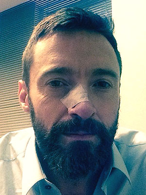 Hugh Jackman Treated for Skin Cancer Again