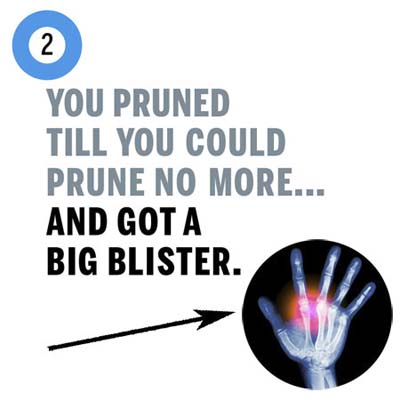 you got a blister from pruning