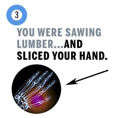 you sliced your hand sawing lumber