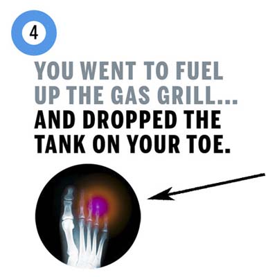 you dropped the fuel tank on your toe